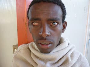 Blind Ethiopian ready for treatment