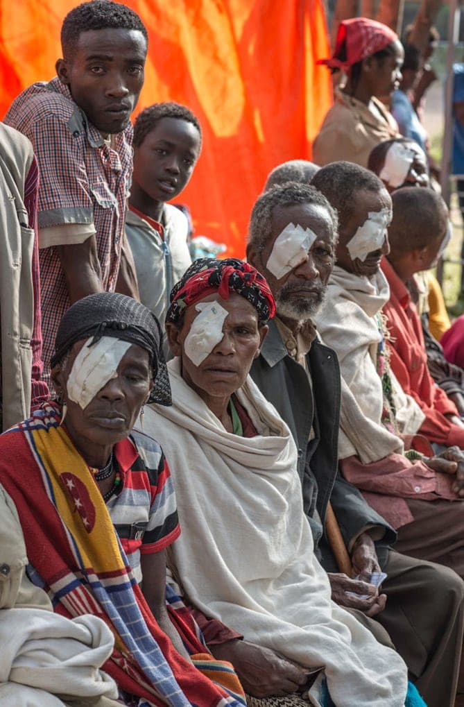 Group of Ethiopian patients recovering from eye treatment